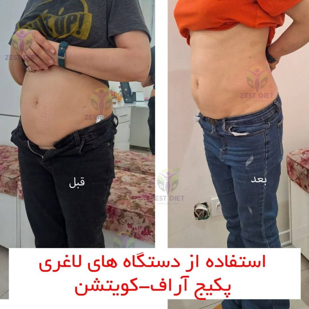 لاغری سریع شکم